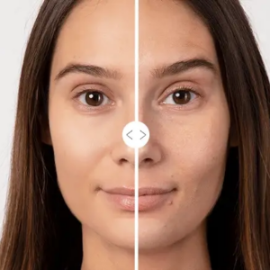 Kit anti edad acido hialuronico skin car